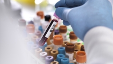 Test tubes in a lab Test tubes in a lab