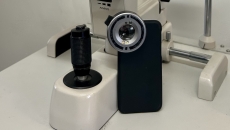 A prototype smartphone camera add-on that can detect UV damage to the eye A prototype smartphone camera add-on that can detect UV damage to the eye