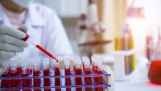 Laboratory worker working with blood tests Laboratory worker working with blood tests