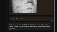 Screenshot of Harrison.rad.1 interface Screenshot of Harrison.rad.1 interface