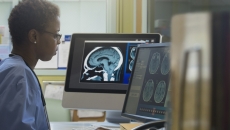 Healthcare professional examining an x-ray Healthcare professional examining an x-ray