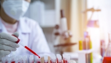 Clinician analyzing blood samples Clinician analyzing blood samples