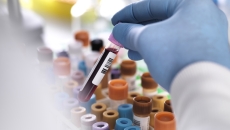 Closeup of test tube Closeup of test tube