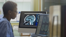 A radiologist looking at brain imaging results in a hospital. A radiologist looking at brain imaging results in a hospital.
