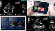 The pair aim to make AI-enhanced diagnostics accessible beyond hospital settings. Ultromics, ultrasound, AI, dianostics, Caption Health
