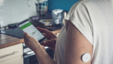 A person wearing CGM tracking blood glucose data on a smartphone A person wearing CGM tracking blood glucose data on a smartphone