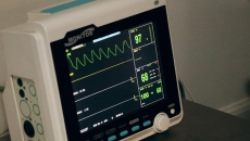 An ECG monitor