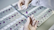 A stained slide being prepared for AI-powered analysis A stained slide being prepared for AI-powered analysis