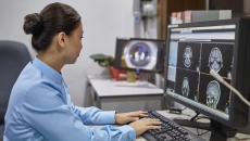 A radiologist looking at brain scans A radiologist looking at brain scans