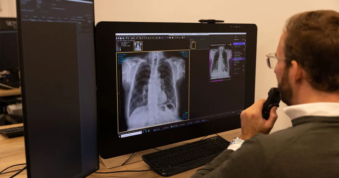 A radiologist reviewing an AI-generated chest X-ray analysis A radiologist reviewing an AI-generated chest X-ray analysis