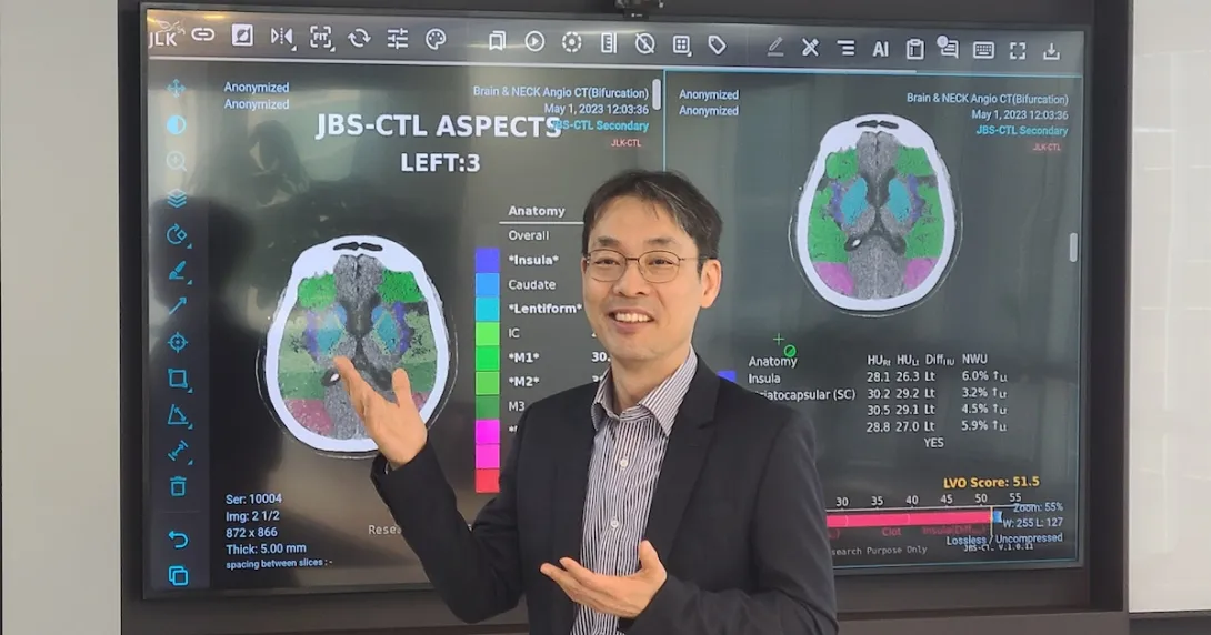 JLK CEO Dong-Min Kim showcasing their stroke AI solution JLK CEO Dong-Min Kim showcasing their stroke AI solution