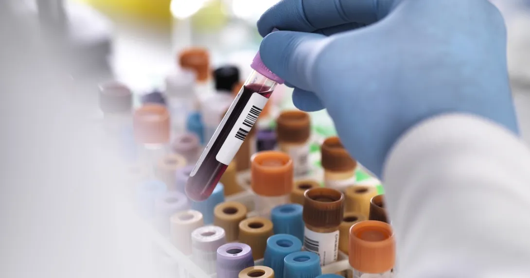 Test tubes in a lab Test tubes in a lab