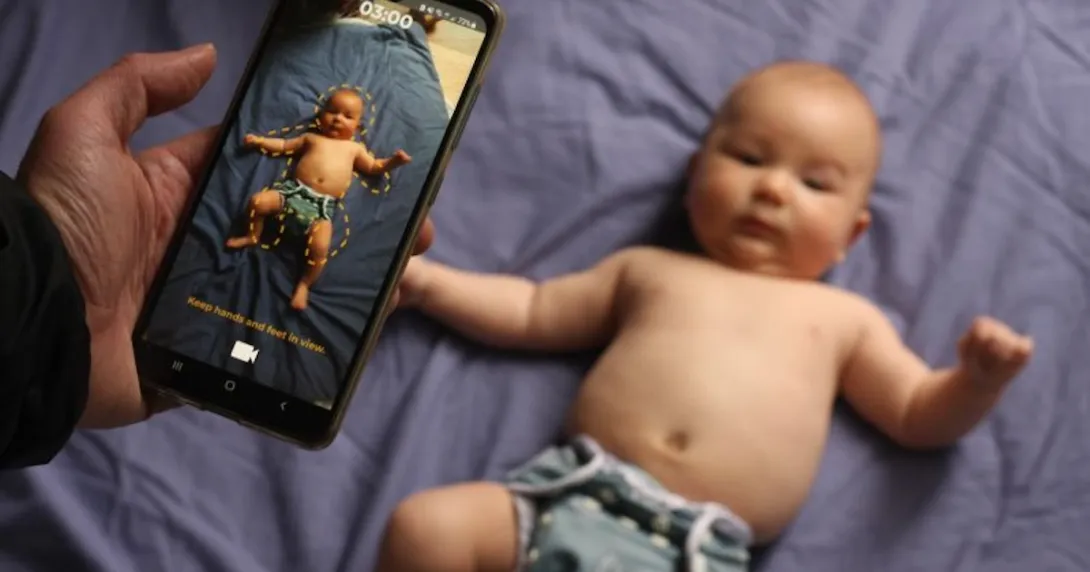 Mobile cerebral palsy assessment app by the University of Melbourne Mobile cerebral palsy assessment app by the University of Melbourne