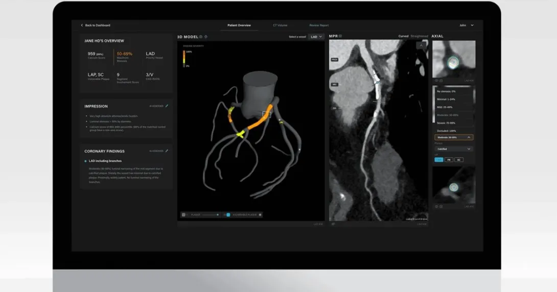 Artrya Salix AI-powered coronary plaque assessment software Artrya Salix AI-powered coronary plaque assessment software