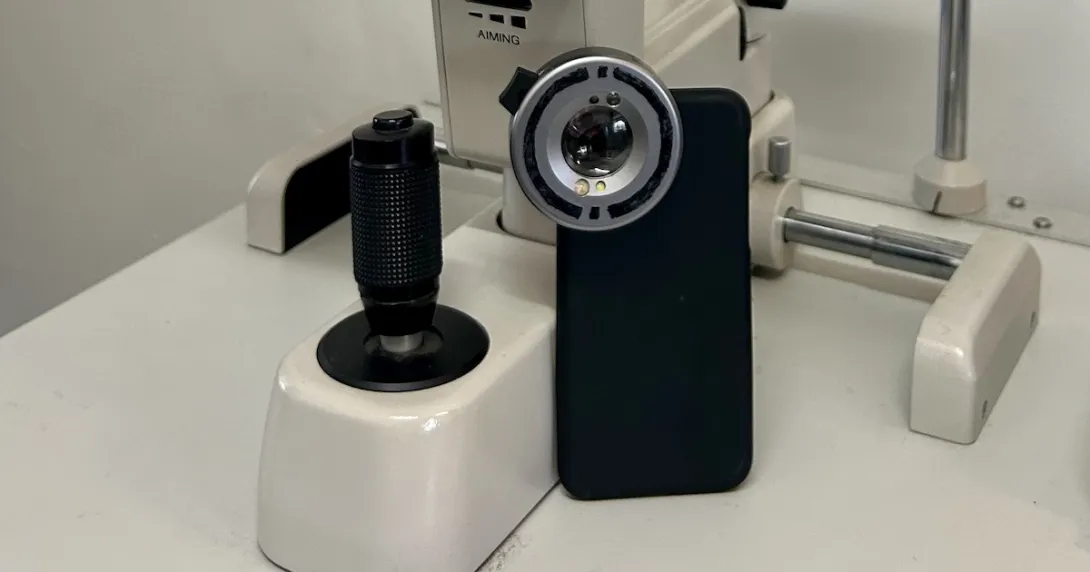 A prototype smartphone camera add-on that can detect UV damage to the eye A prototype smartphone camera add-on that can detect UV damage to the eye