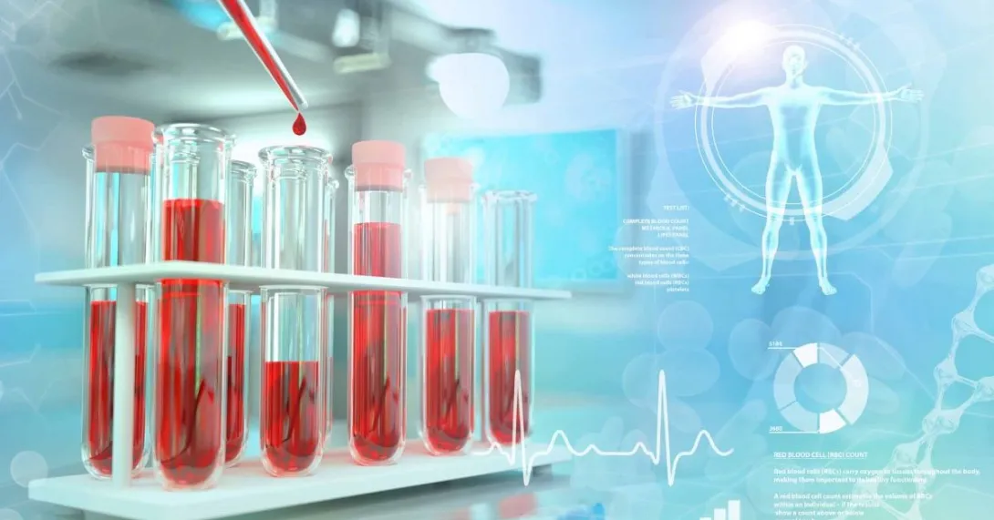 blood test lab illustration Blood test lab illustration