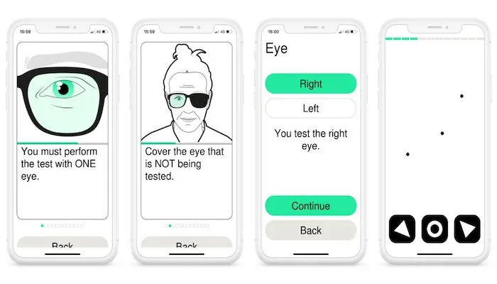 The German pharma giant is working with top eye hospitals in the country to support virtual care for patients with Diabetic Macular Edema or age-related macular degeneration. Diabetic Macular Edema, Alleye, age-related macular degeneration, bayer