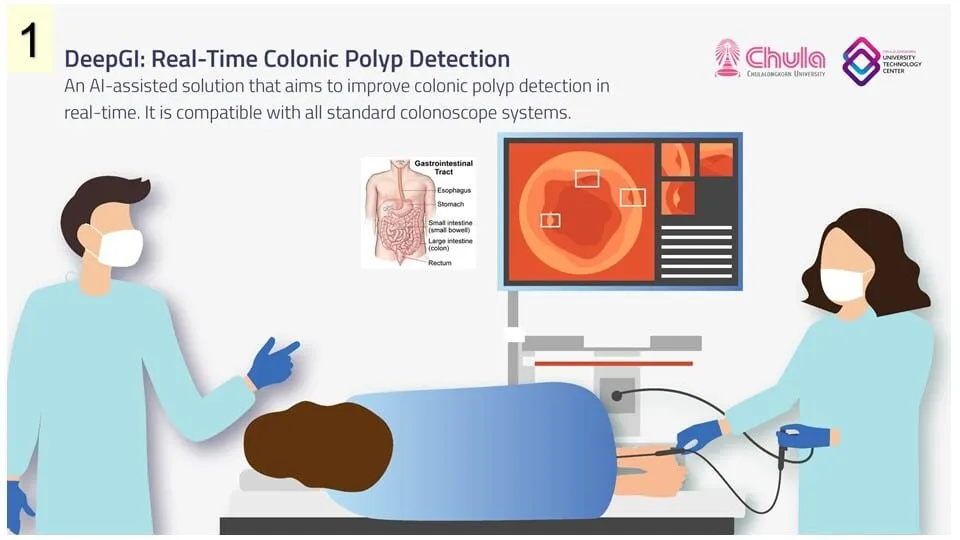 An animated visual of a gastrointestinal endoscopy procedure using DeepGI