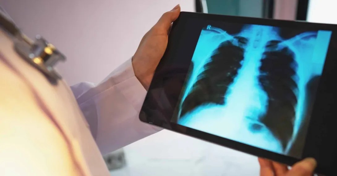 Doctor checking a chest X-ray film on a tablet Doctor checking a chest X-ray film on a tablet