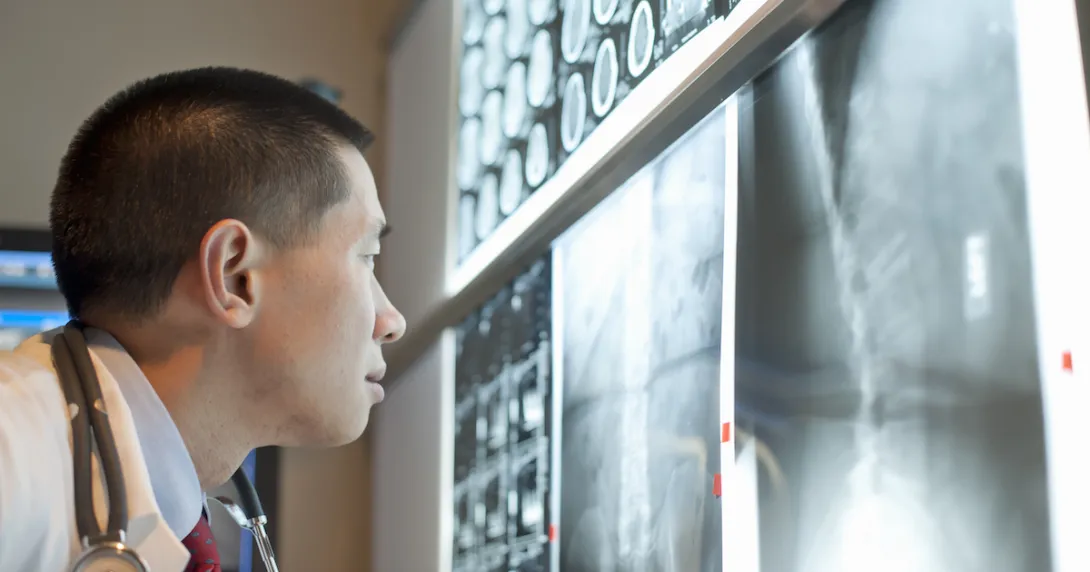 Healthcare provider looking at X-rays on a wall Healthcare provider looking at X-rays on a wall