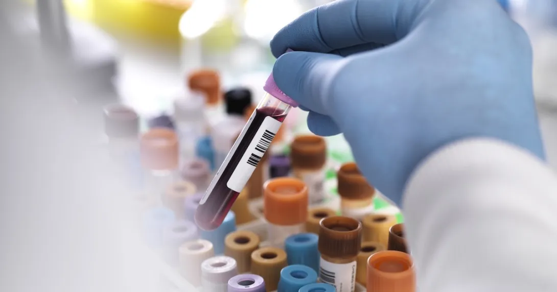 Closeup of test tube Closeup of test tube