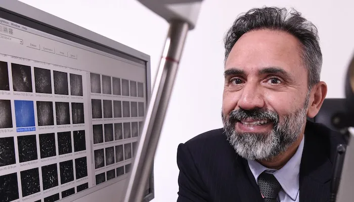 The non-invasive eye examination is also used to identify conditions such as diabetic neuropathy, Parkinson’s disease, multiple sclerosis, and dementia. corneal confocal microscopy, COVID-19, long COVID, ophthalmology, Weill Cornell Medicine-Qatar