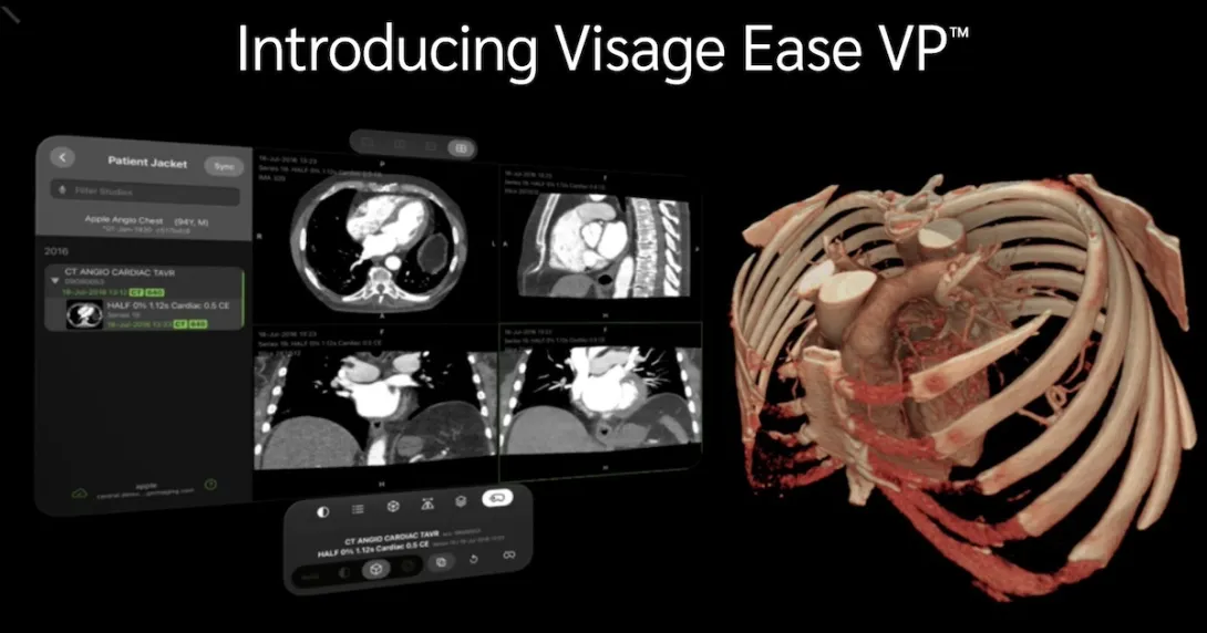 Visage Ease VP Visage Ease VP