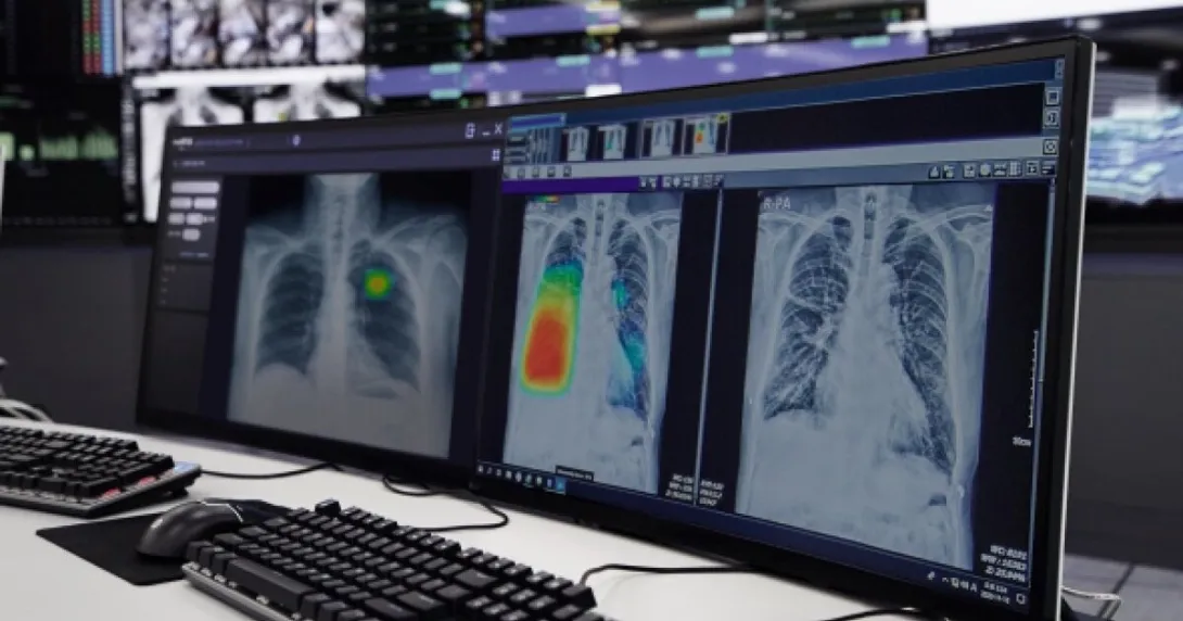 Chest x-ray images being analysed by Lunit INSIGHT CXR software