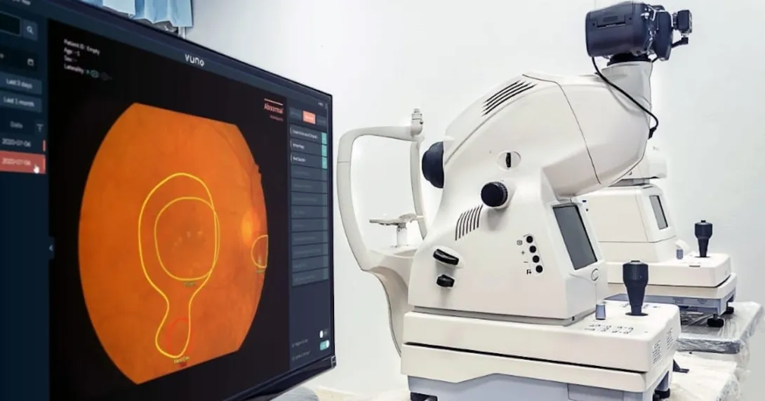 VUNO Med-Fundus AI software by VUNO