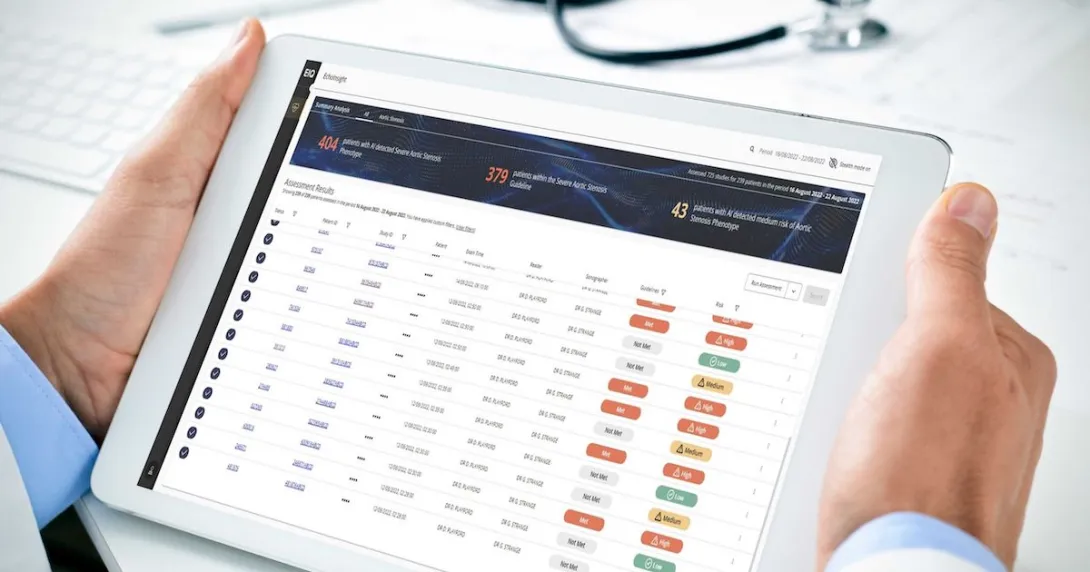 Echo IQ's heart disease diagnosis support AI software Echo IQ's heart disease diagnosis support AI software