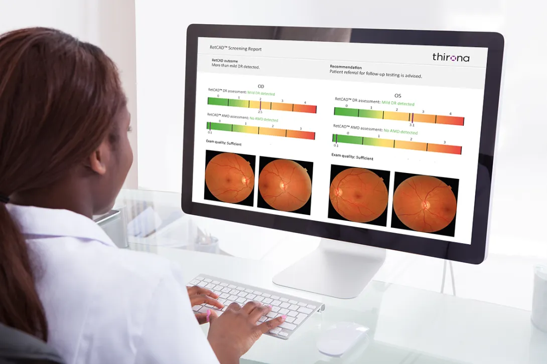 Also, PocDoc to launch smartphone-based blood test for cardiovascular disease. AXA Health, Thirona, Sectra, AI, Peppy