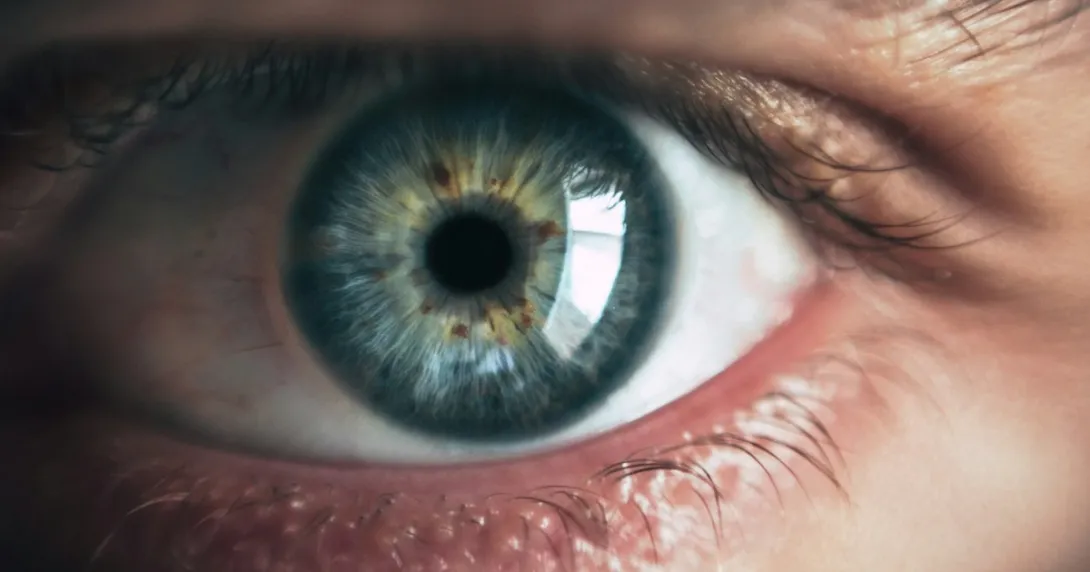 Alt text: A person's eye Alt text: A person's eye